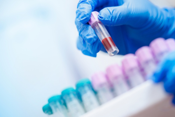 Назван весомый аргумент в пользу обязательного теста ДНК в роддомах