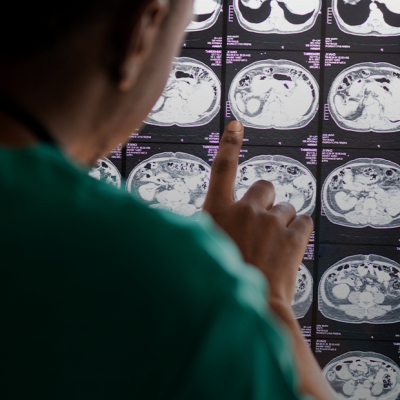 «Мозг — это как космос, скрытый в черепе»